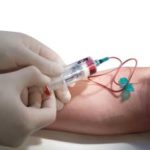 injection de P.R.P : le prélèvement injection de P.R.P : le prélèvement