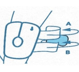 schema-genou-3