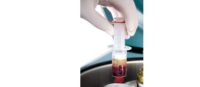 separation-prp Les injections de P.R.P. pour soigner l'arthrose