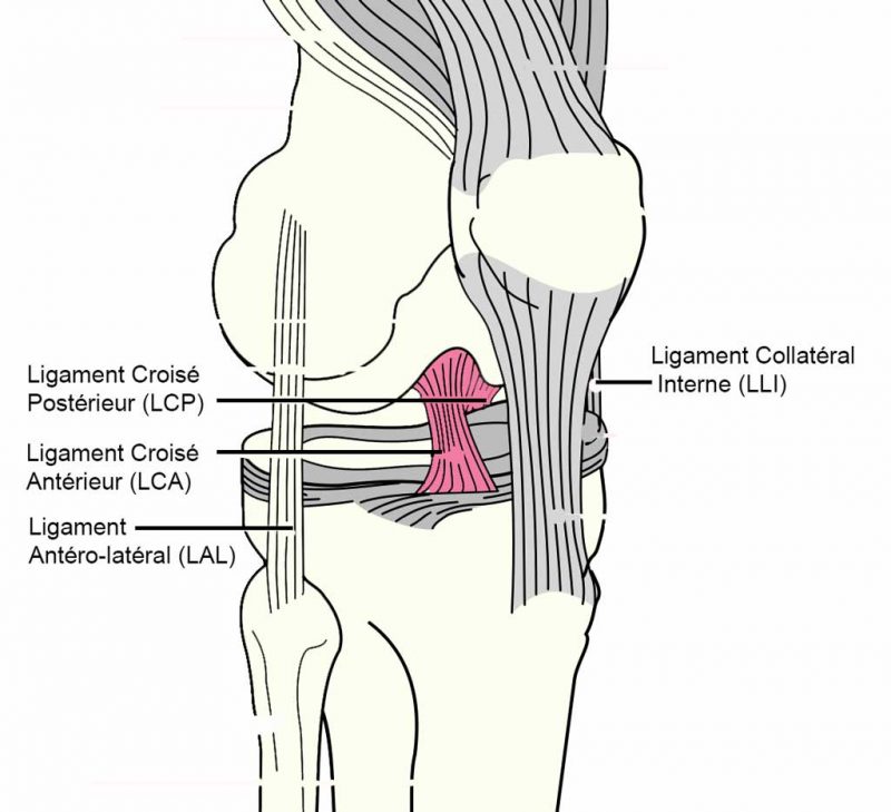 Réparation ou reconstruction du ligament croisé antérieur du genou sous arthroscopie