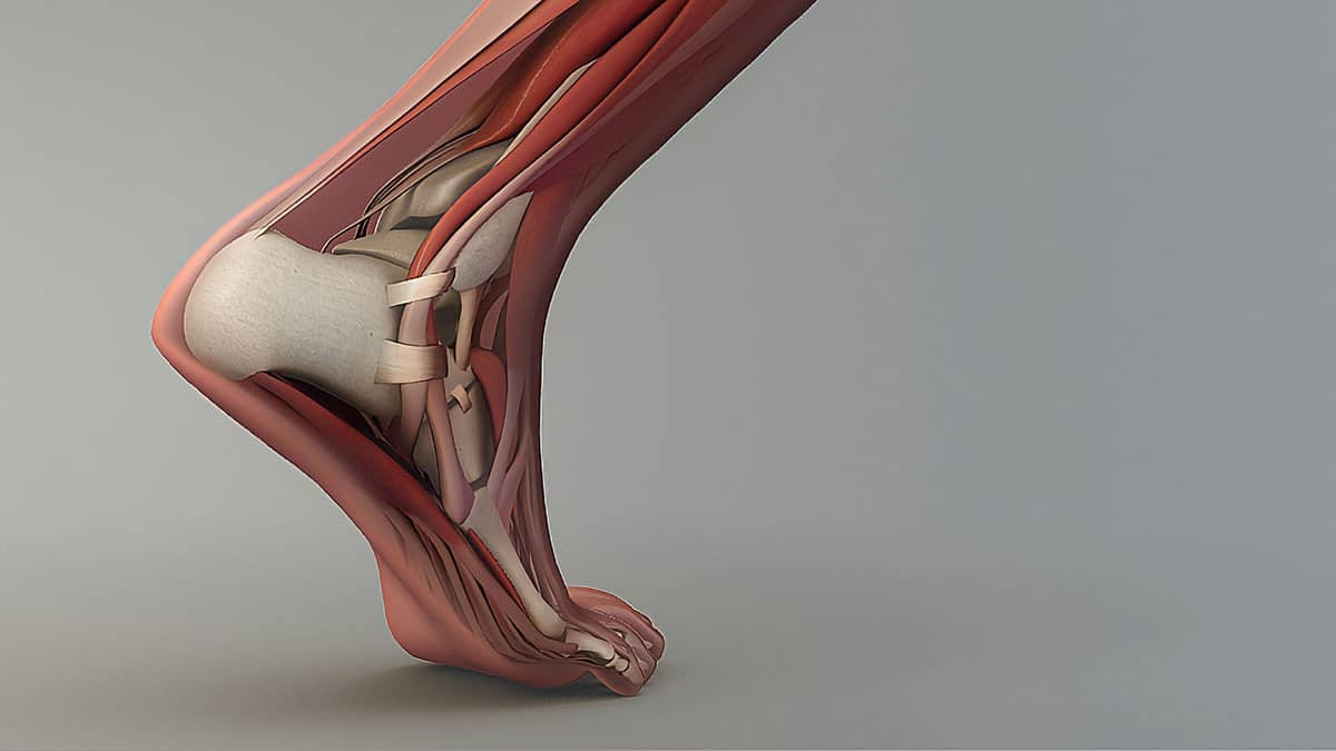 Le conflit de cheville est lié à un contact excessif entre les os de cette articulation. 