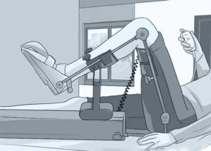 arthromoteur arthromoteur