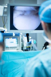Qu'est-ce que l'arthroscopie ? - Dr Philippe LORIAUT | Chirurgien  Orthopdiste Paris
