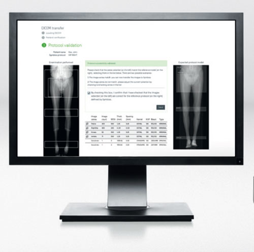 Un bilan d'imagerie selon un protocole précis pour planification d'une prothèse totale du genou personnalisée.