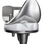 prothèse de genou Symbios prothèse de genou Symbios