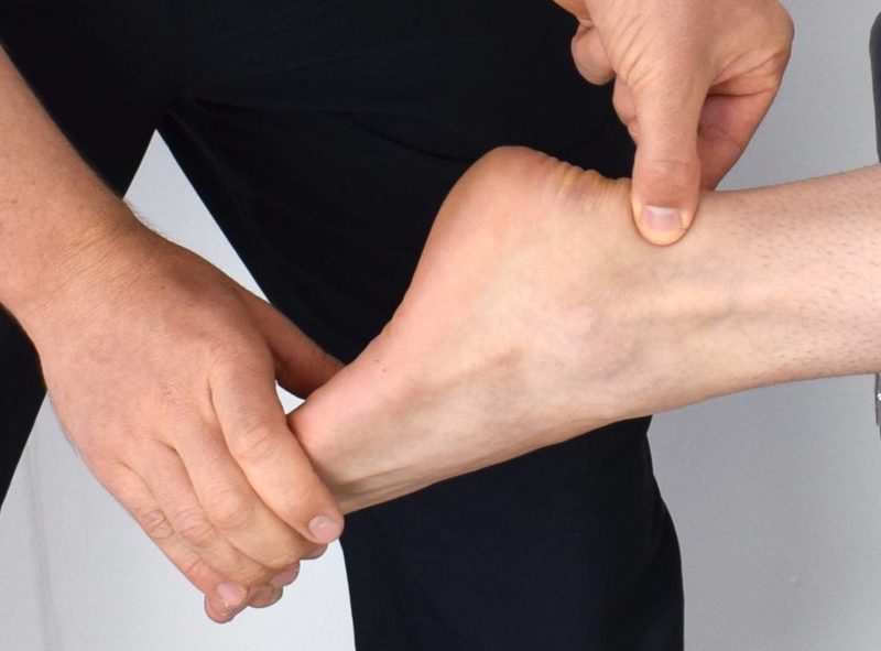 Rupture traumatique du tendon d'Achille Dr