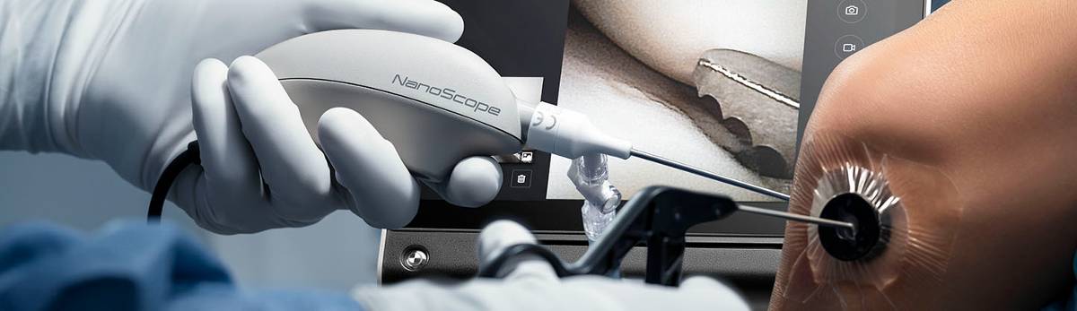 Une première en chirurgie des ligaments du genou avec dispositif mini-invasif NanoScope