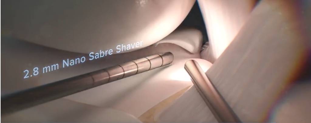 Le Nano Sabre Shaver, un rasoir motorisé