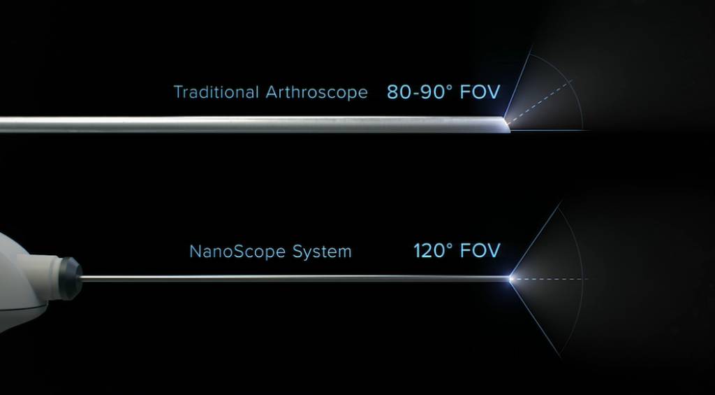 NanoScope : un champ de vision élargi