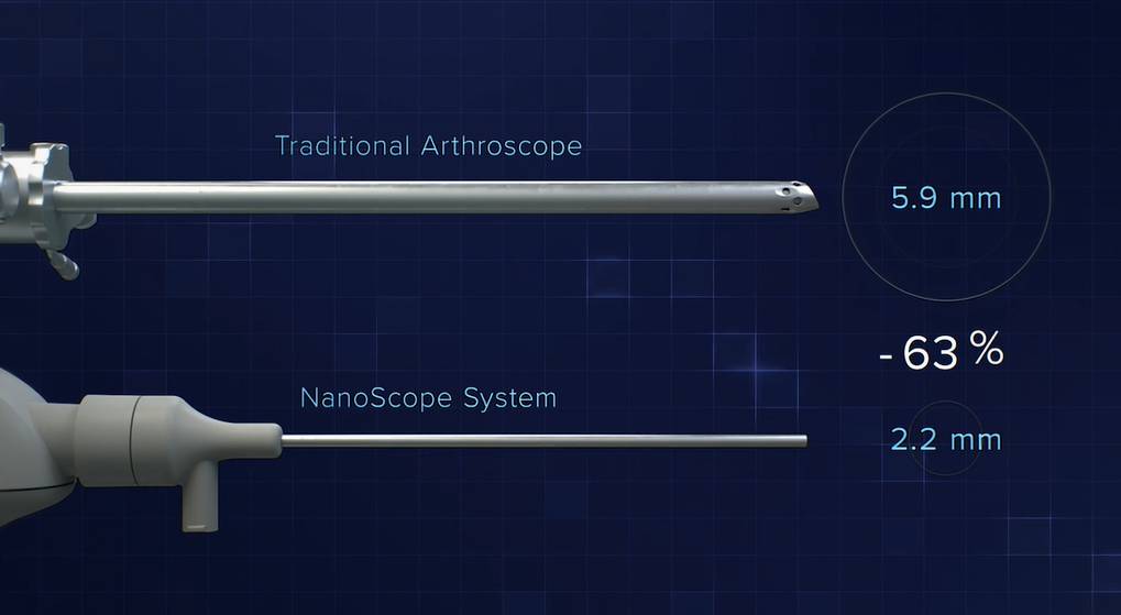Le nanoscope est une évolution de l’arthroscope avec une miniaturisation remarquable et une meilleure ergonomie.